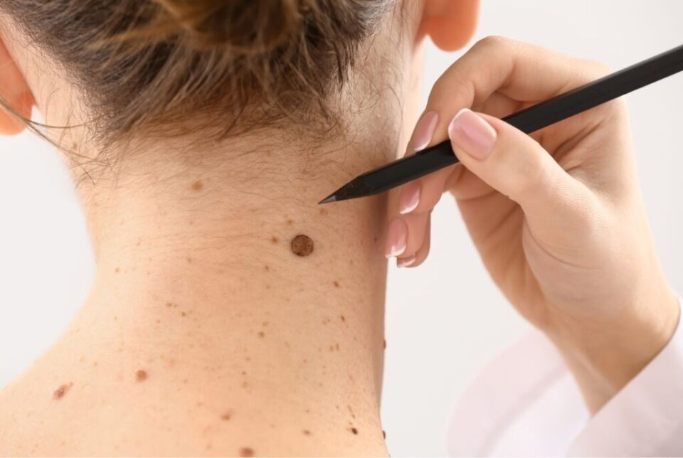 Skin cancer check consultation in progress - Dermatology Clinics Australia